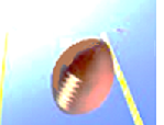 field goal